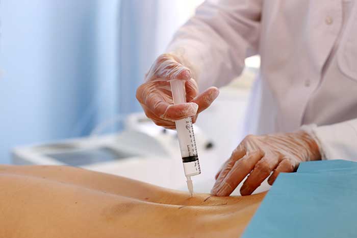 administracion-dolor-espalda administracion-dolor-espalda